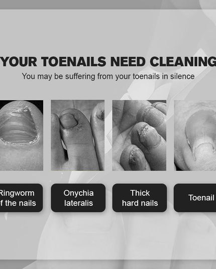 Last Day Promotion（50% OFF ）Medical-grade Nail Clippers - Libiyi